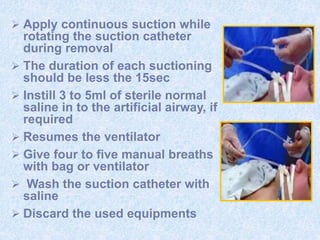  Apply continuous suction while
rotating the suction catheter
during removal
 The duration of each suctioning
should be less the 15sec
 Instill 3 to 5ml of sterile normal
saline in to the artificial airway, if
required
 Resumes the ventilator
 Give four to five manual breaths
with bag or ventilator
 Wash the suction catheter with
saline
 Discard the used equipments
 