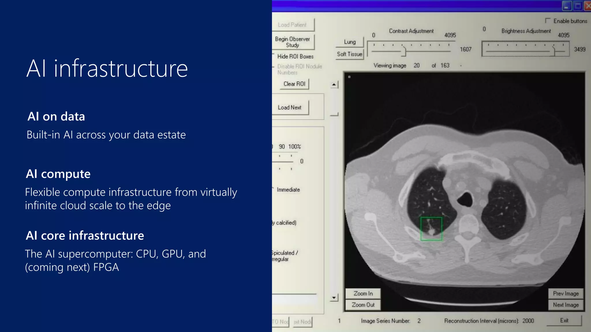 AI core infrastructure
AI compute
AI on data
 