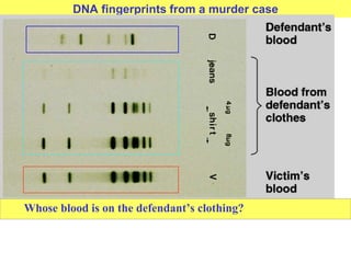 DNA fingerprints from a murder case
Whose blood is on the defendant’s clothing?
 