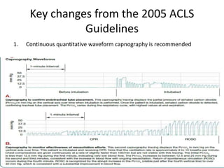 Key changes from the 2005 ACLS
Guidelines
1. Continuous quantitative waveform capnography is recommended
 