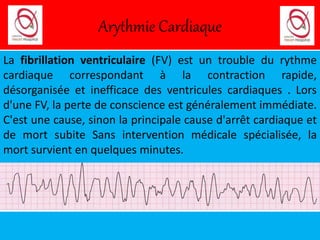 Rythme Cardiaque Rapide: Causes Et Traitements – GTEN