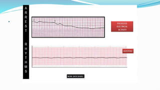 Advanced Cardiac Life support ppt2021.pptx