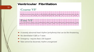  A severely abnormal heart rhythm (arrhythmia) that can be life-threatening.
 No identifiable P, QRS or T wave
 Emergency- requires Basic Life Support
 Rate cannot be discerned, rhythm unorganized
10
 
