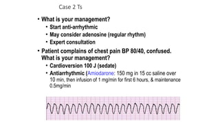 Case 2 Ts
• What is your management?
• Start anti-arrhythmic
• May consider adenosine (regular rhythm)
• Expert consultation
• Patient complains of chest pain BP 80/40, confused.
What is your management?
• Cardioversion 100 J (sedate)
• Antiarrhythmic (Amiodarone: 150 mg in 15 cc saline over
10 min, then infusion of 1 mg/min for first 6 hours, & maintenance
0.5mg/min
 