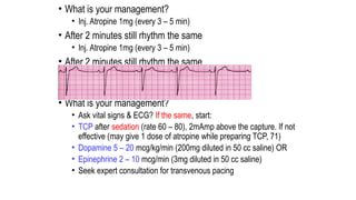 • What is your management?
• Inj. Atropine 1mg (every 3 – 5 min)
• After 2 minutes still rhythm the same
• Inj. Atropine 1mg (every 3 – 5 min)
• After 2 minutes still rhythm the same
• Inj. Atropine 1mg (max. 3mg over)
• What is your management?
• Ask vital signs & ECG? If the same, start:
• TCP after sedation (rate 60 – 80), 2mAmp above the capture. If not
effective (may give 1 dose of atropine while preparing TCP, 71)
• Dopamine 5 – 20 mcg/kg/min (200mg diluted in 50 cc saline) OR
• Epinephrine 2 – 10 mcg/min (3mg diluted in 50 cc saline)
• Seek expert consultation for transvenous pacing
 