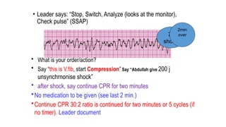 • Leader says: “Stop, Switch, Analyze (looks at the monitor),
Check pulse” (SSAP)
• What is your order/action?
• Say “this is V.fib, start Compression” Say “Abdullah give 200 j
unsynchrnonise shock”
• after shock, say continue CPR for two minutes
•No medication to be given (see last 2 min.)
•Continue CPR 30:2 ratio is continued for two minutes or 5 cycles (if
no timer). Leader document
7th
shock
2min
over
 