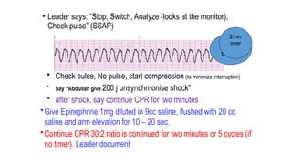 • Leader says: “Stop, Switch, Analyze (looks at the monitor),
Check pulse” (SSAP)
• Check pulse, No pulse, start compression (to minimize interruption)
• Say “Abdullah give 200 j unsynchrnonise shock”
• after shock, say continue CPR for two minutes
•Give Epinephrine 1mg diluted in 9cc saline, flushed with 20 cc
saline and arm elevation for 10 – 20 sec.
•Continue CPR 30:2 ratio is continued for two minutes or 5 cycles (if
no timer). Leader document
6th
shock
2min
over
 