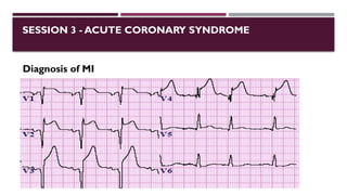 SESSION 3 - ACUTE CORONARY SYNDROME
Diagnosis of MI
 