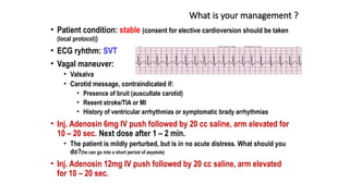 What is your management ?
• Patient condition: stable (consent for elective cardioversion should be taken
(local protocol))
• ECG ryhthm: SVT
• Vagal maneuver:
• Valsalva
• Carotid message, contraindicated if:
• Presence of bruit (auscultate carotid)
• Resent stroke/TIA or MI
• History of ventricular arrhythmias or symptomatic brady arrhythmias
• Inj. Adenosin 6mg IV push followed by 20 cc saline, arm elevated for
10 – 20 sec. Next dose after 1 – 2 min.
• The patient is mildly perturbed, but is in no acute distress. What should you
do?(he can go into a short period of asystole)
• Inj. Adenosin 12mg IV push followed by 20 cc saline, arm elevated
for 10 – 20 sec.
 