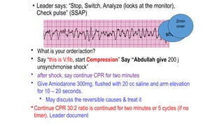 • Leader says: “Stop, Switch, Analyze (looks at the monitor),
Check pulse” (SSAP)
• What is your order/action?
• Say “this is V.fib, start Compression” Say “Abdullah give 200 j
unsynchrnonise shock”
• after shock, say continue CPR for two minutes
• Give Amiodarone 300mg, flushed with 20 cc saline and arm elevation
for 10 – 20 seconds.
• May discuss the reversible causes & treat it
• Continue CPR 30:2 ratio is continued for two minutes or 5 cycles (if no
timer). Leader document
3rd
shock
2min
over
 