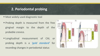 Probing Deep advanced diagnostic aids in periodontics.pptx