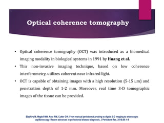 Oct Modality advanced diagnostic aids in periodontics | PPTX