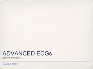 Alastair Jones
ADVANCED ECGs
Beyond the basics…
 