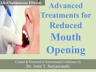 Advanced
Treatments for
Reduced
Mouth
Opening
Created & Presented at International Conference by
Dr. Amit T. Suryawanshi
Oral Submucous Fibrosis
 
