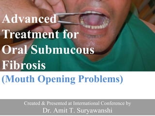 Created & Presented at International Conference by
Dr. Amit T. Suryawanshi
Advanced
Treatment for
Oral Submucous
Fibrosis
(Mouth Opening Problems)
 