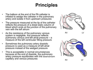 Principles
•   The balloon at the end of the PA catheter is
    inflated to wedge the catheter in the pulmonary
    artery and isolate it from upstream pressures             Pulmonary
                                                                artery

•   The pressure measured at the tip of the catheter
    reflects the pressure of a distal static column of
    blood which ends at the junction of the pulmonary
    vein with the left atrium
•   As the resistance of the pulmonary venous            RV                 LV
    system is negligible, this pressure reflects
    pulmonary venous and left atrial pressure – a
    measure of the left ventricular filling pressure
•   Sometimes the pulmonary artery diastolic
    pressure is used as a measure of left atrial                Pulmonary
                                                                  artery
    pressure instead of the wedged pressure                      wedged


•   This is acceptable in normal circumstances
    because at the end of diastole, the pulmonary
    artery pressure equilibrates with the downstream
    capillary and venous pressures                       RV                 LV
 