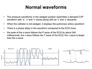 Normal waveforms
           •    The pressure waveforms in the wedged position resembles a damped CVP
                waveform with ‘a’, ‘c’ and ‘v’ waves along with an ‘x’ and ‘y’ descents
           •    When the catheter is not wedged, it displays the pulmonary artery waveform
           •    There is a phase delay in the waveform compared to the ECG trace
           •    the peak of the a wave follows the P wave of the ECG by about 240
                milliseconds; the v wave follows the T wave of the ECG; the v wave is larger
                than the a wave



                 Right atrium   Right ventricle   Pulmonary artery           wedged


           20
pressure




                                                                         v
                                                                     a
           10

                                                                                      a   v
 