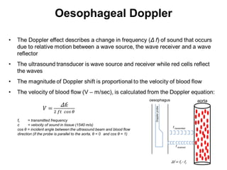 Oesophageal Doppler




                                                                         oesophagus                          aorta




                                                                            Doppler probe
ft     = transmitted frequency
c      = velocity of sound in tissue (1540 m/s)
                                                                                             f transmitted
cos θ = incident angle between the ultrasound beam and blood flow
direction (if the probe is parallel to the aorta, θ = 0 and cos θ = 1)


                                                                                               f received



                                                                                            Δf = ft - fr
 
