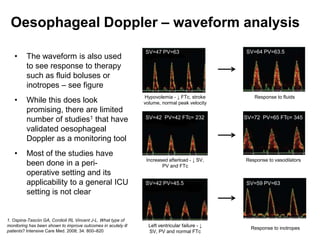 Oesophageal Doppler – waveform analysis
                                                               SV=47 PV=63                      SV=64 PV=63.5
   •     The waveform is also used
         to see response to therapy
         such as fluid boluses or
         inotropes – see figure
                                                               Hypovolemia - ↓ FTc, stroke         Response to fluids
   •     While this does look                                  volume, normal peak velocity
         promising, there are limited
         number of studies1 that have                          SV=42 PV=42 FTc= 232             SV=72 PV=65 FTc= 345

         validated oesophageal
         Doppler as a monitoring tool
   •     Most of the studies have
                                                                Increased afterload - ↓ SV,     Response to vasodilators
         been done in a peri-                                          PV and FTc
         operative setting and its
         applicability to a general ICU                        SV=42 PV=45.5                    SV=59 PV=63
         setting is not clear


1. Ospina-Tascón GA, Cordioli RL Vincent J-L. What type of
monitoring has been shown to improve outcomes in acutely ill     Left ventricular failure - ↓
                                                                                                  Response to inotropes
patients? Intensive Care Med. 2008; 34: 800–820                  SV, PV and normal FTc
 
