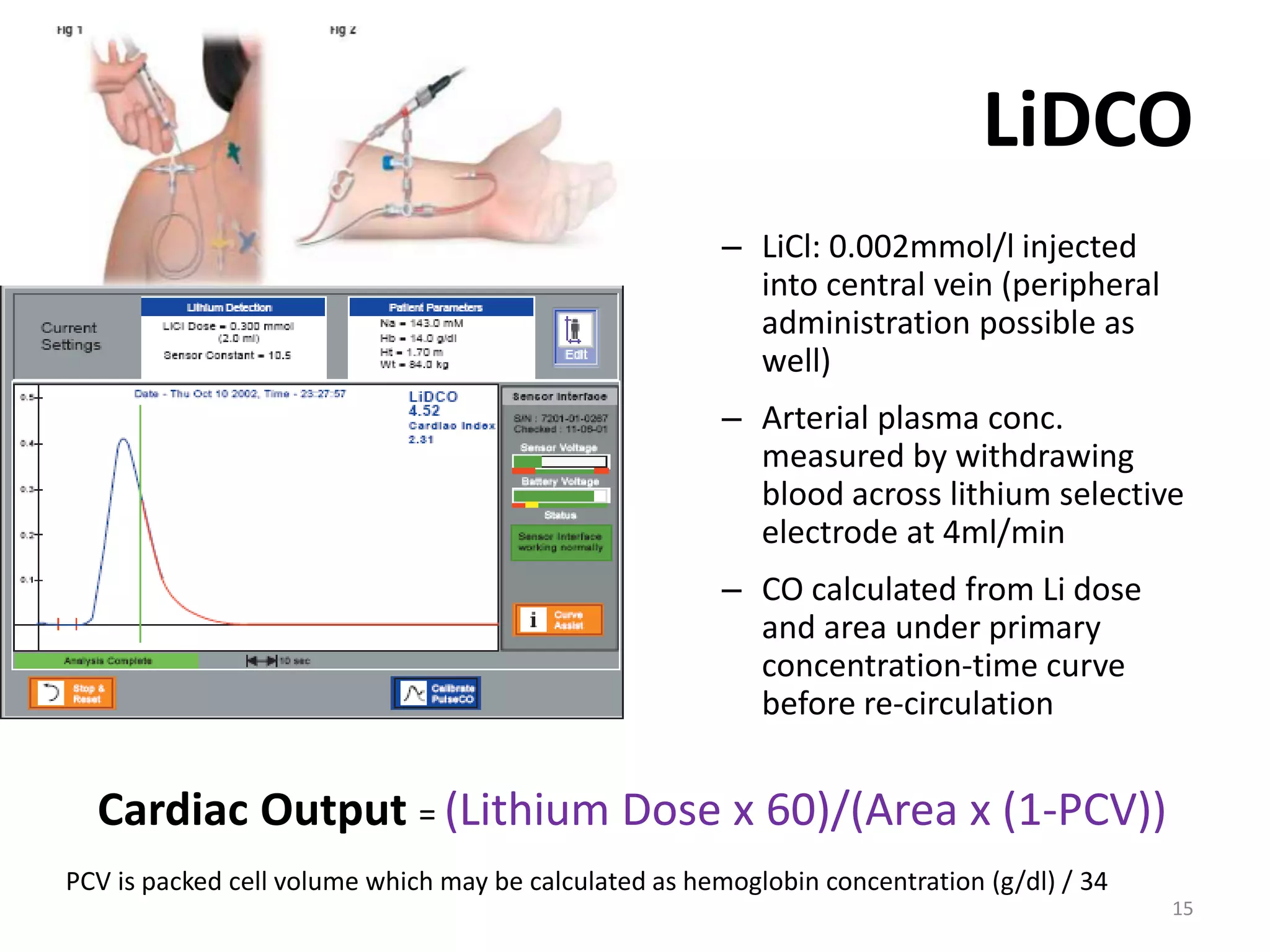 LiDCO
– LiCl: 0.002mmol/l injected
into central vein (peripheral
administration possible as
well)
– Arterial plasma conc.
measured by withdrawing
blood across lithium selective
electrode at 4ml/min
– CO calculated from Li dose
and area under primary
concentration-time curve
before re-circulation
PCV is packed cell volume which may be calculated as hemoglobin concentration (g/dl) / 34
Cardiac Output = (Lithium Dose x 60)/(Area x (1-PCV))
15
 