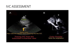 ADVANCED HEMODYNAMIC MONITORING IN CRITICAL CARE MEDICINE | PPTX