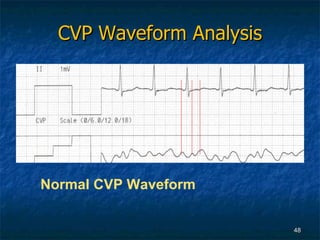 Advanced Hemodynamics | PPT