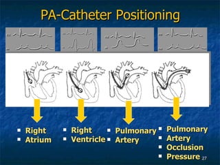 PA-Catheter Positioning <ul><li>Right </li></ul><ul><li>Atrium </li></ul><ul><li>Right </li></ul><ul><li>Ventricle </li></...