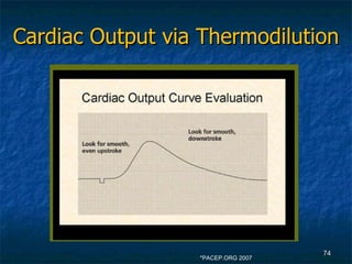 Cardiac Output via Thermodilution *PACEP.ORG 2007 
