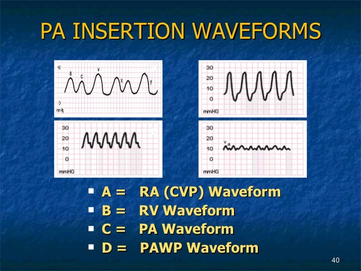 Advanced Hemodynamics