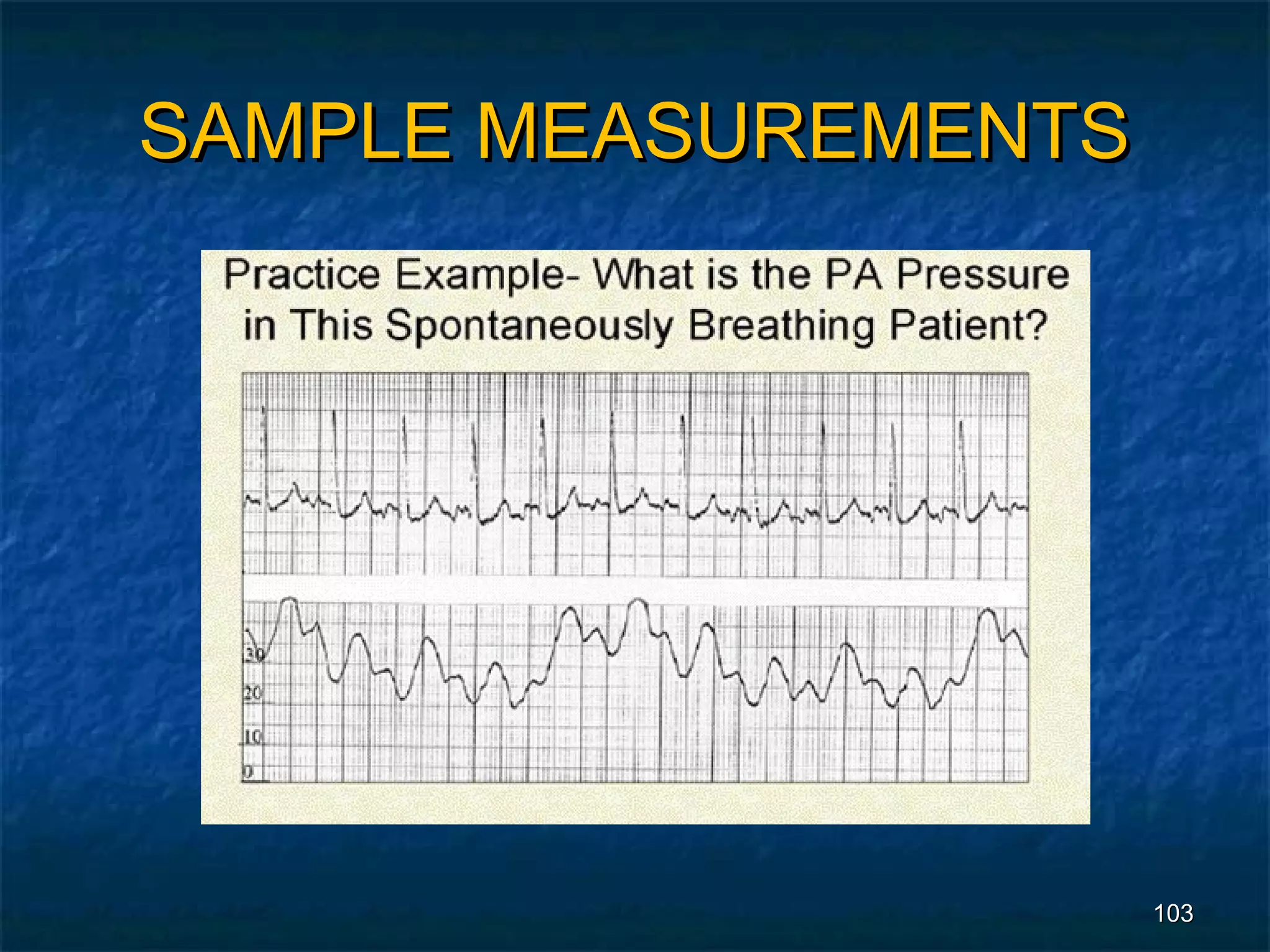 SAMPLE MEASUREMENTS




                      103
 