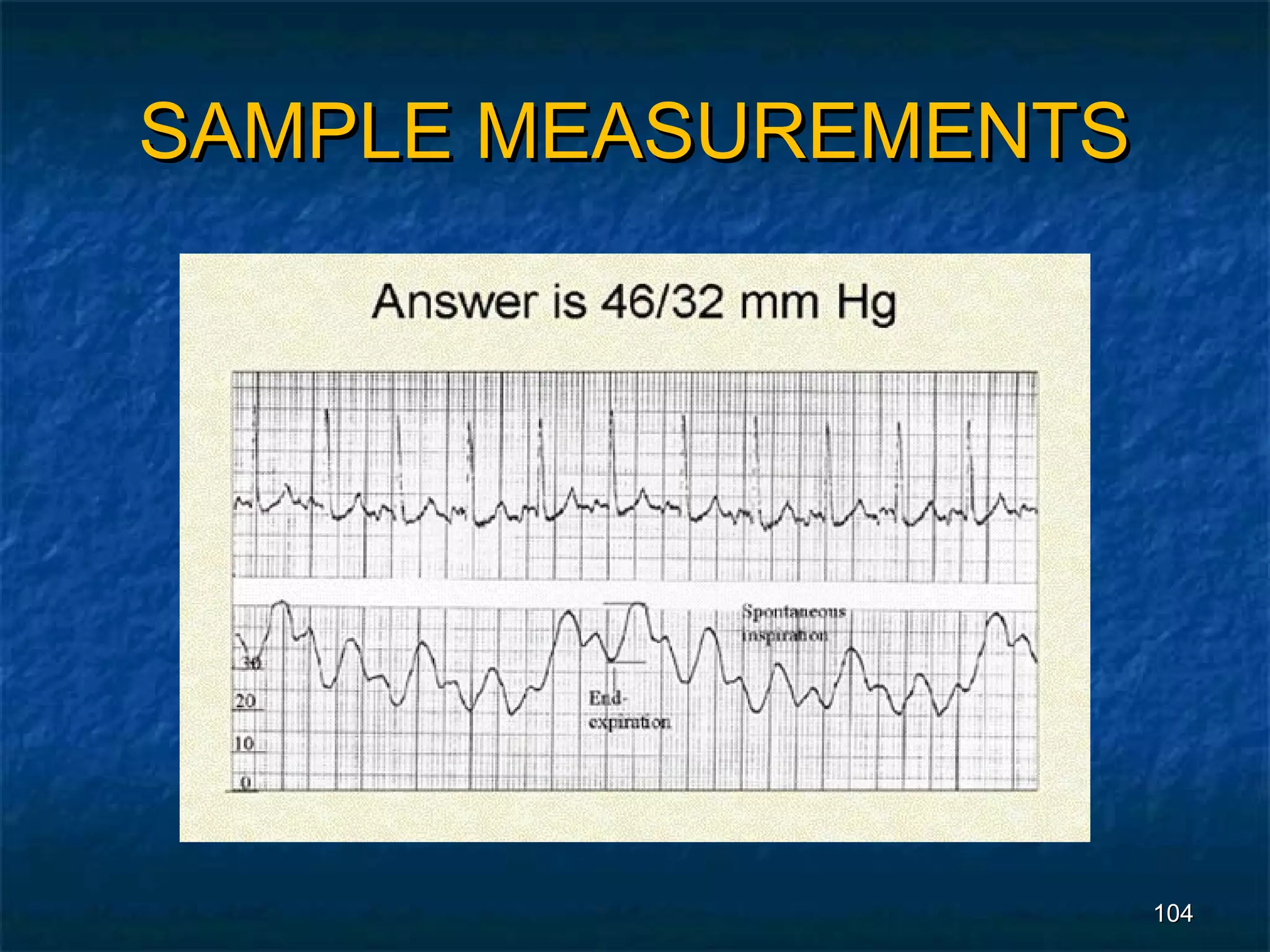 SAMPLE MEASUREMENTS




                      104
 