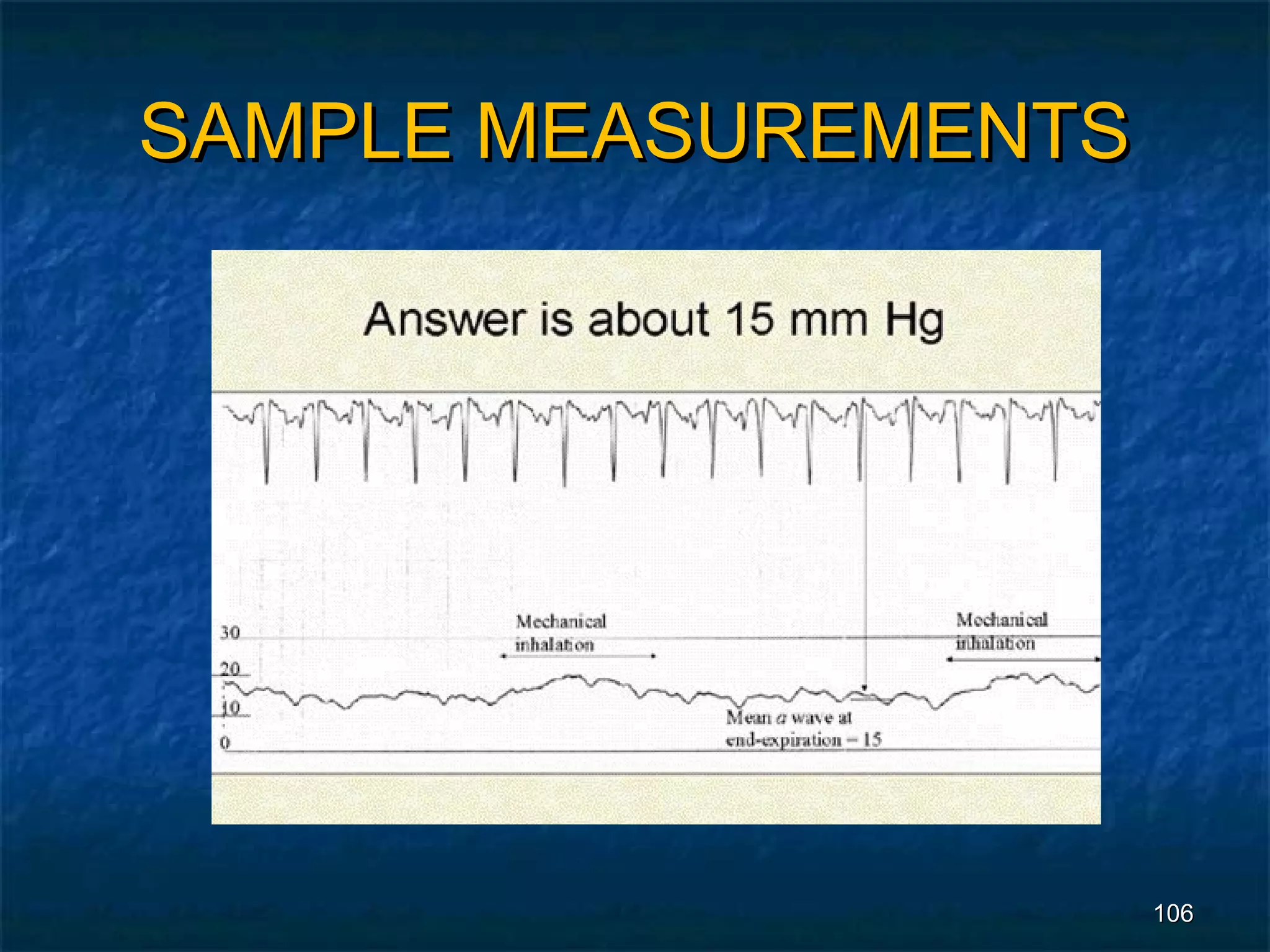 SAMPLE MEASUREMENTS




                      106
 