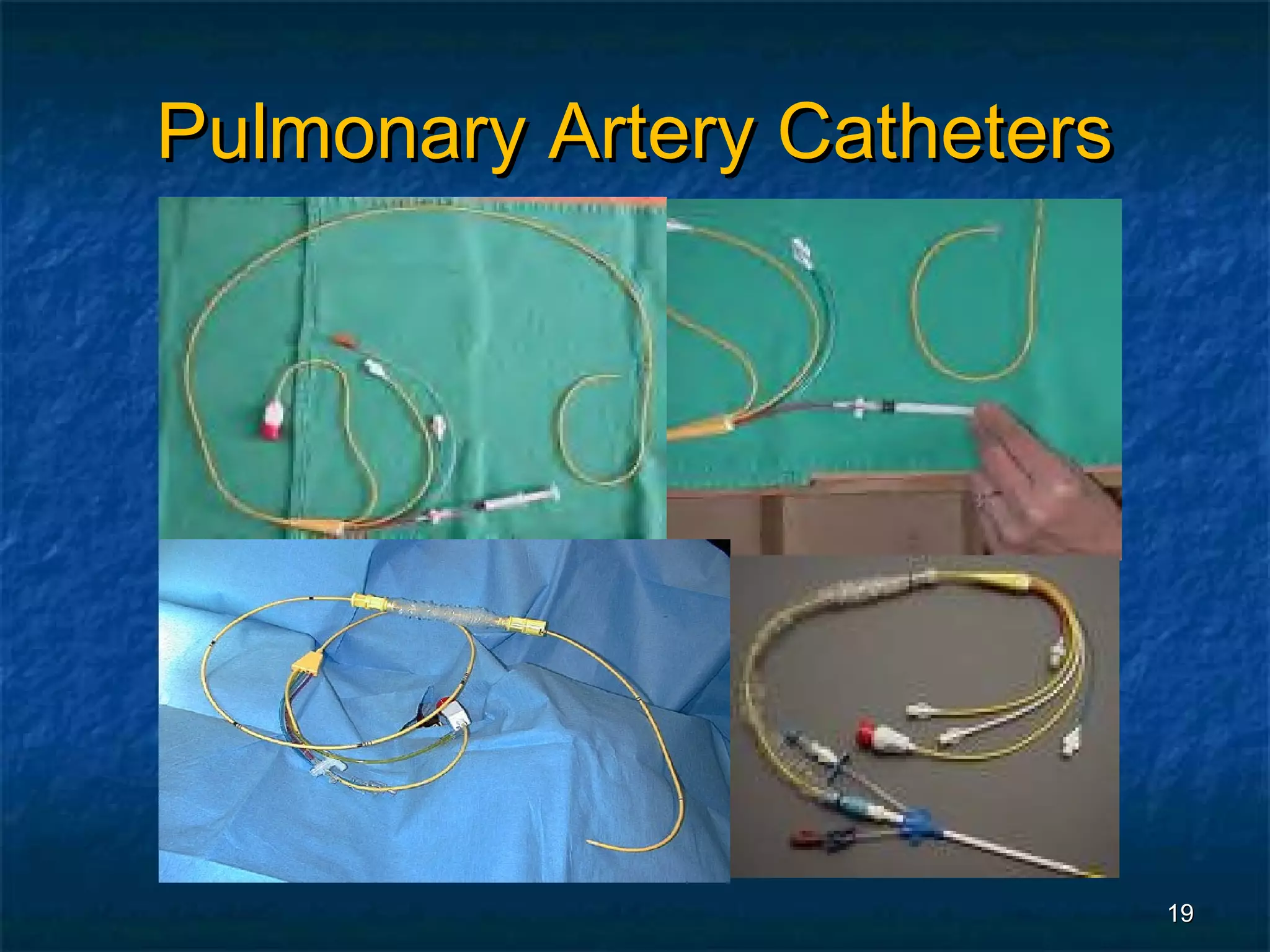 Pulmonary Artery Catheters




                             19
 
