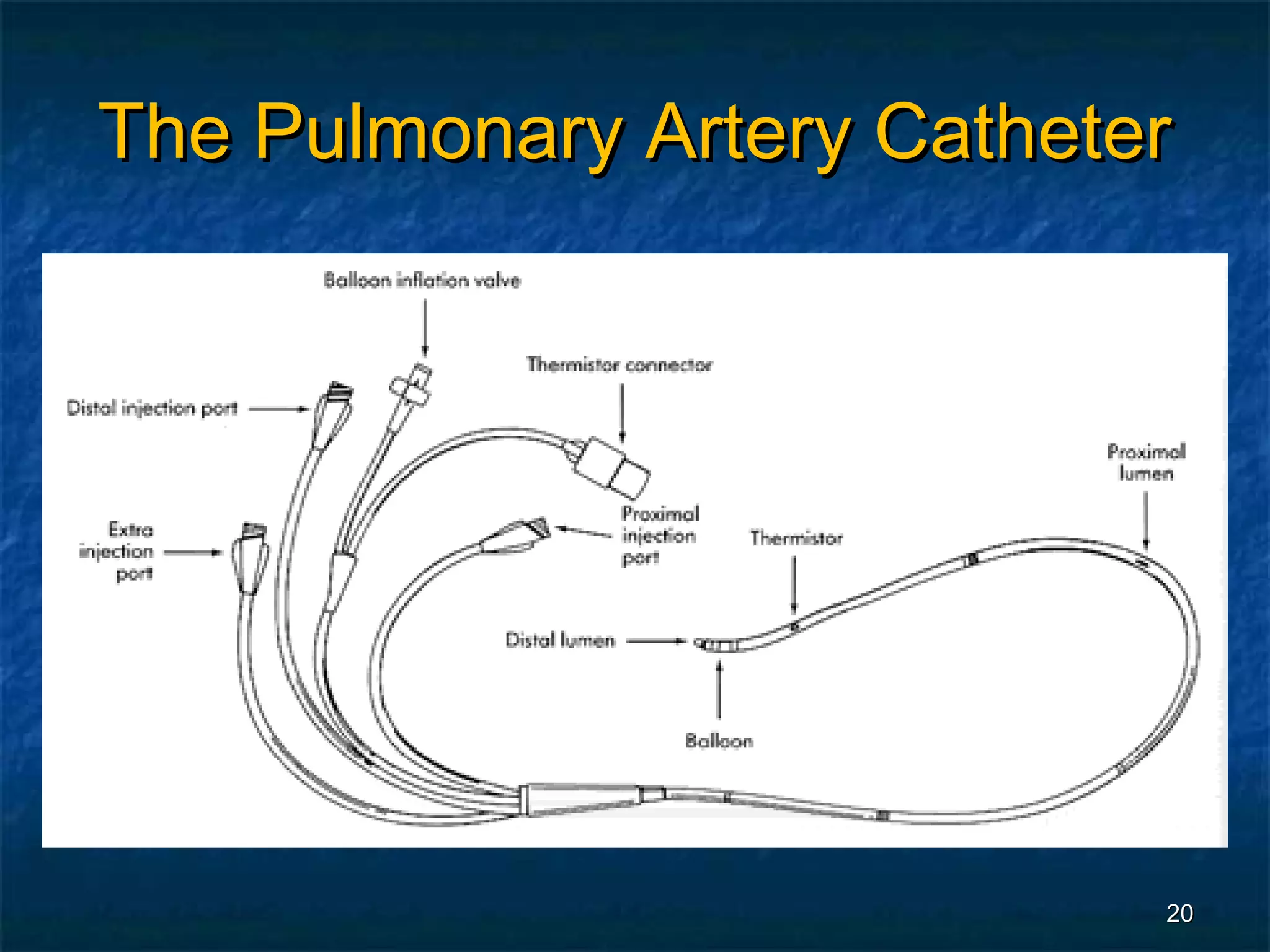 The Pulmonary Artery Catheter




                            20
 