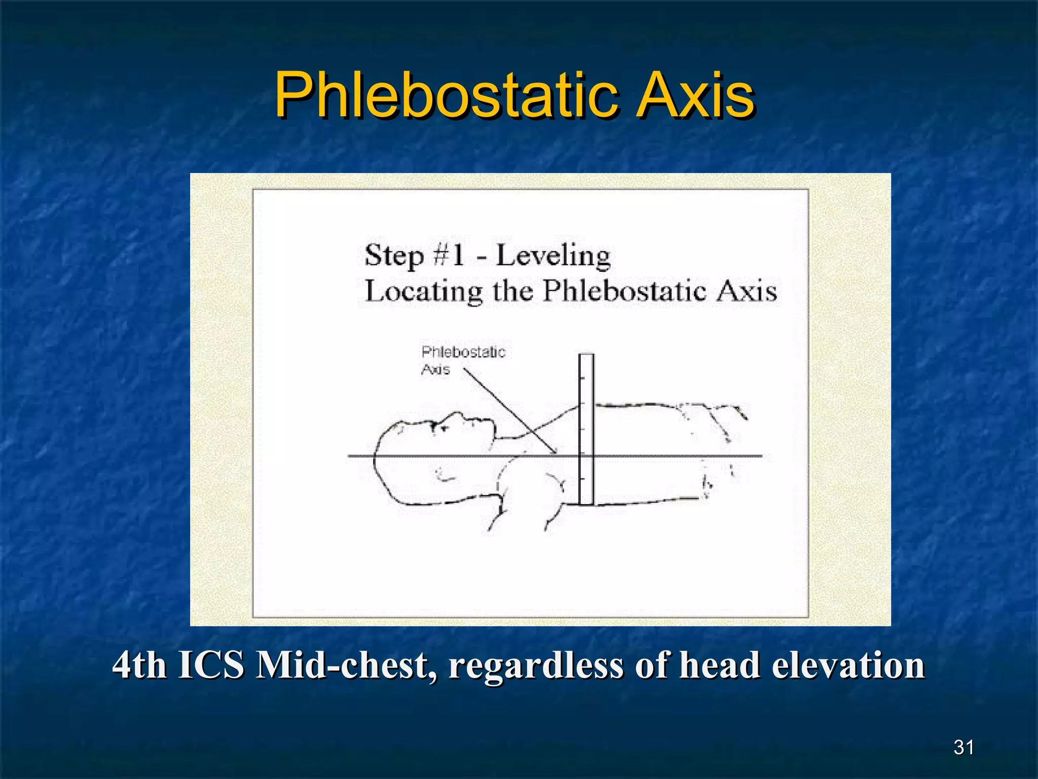 Phlebostatic Axis




4th ICS Mid-chest, regardless of head elevation
                                                  31
 