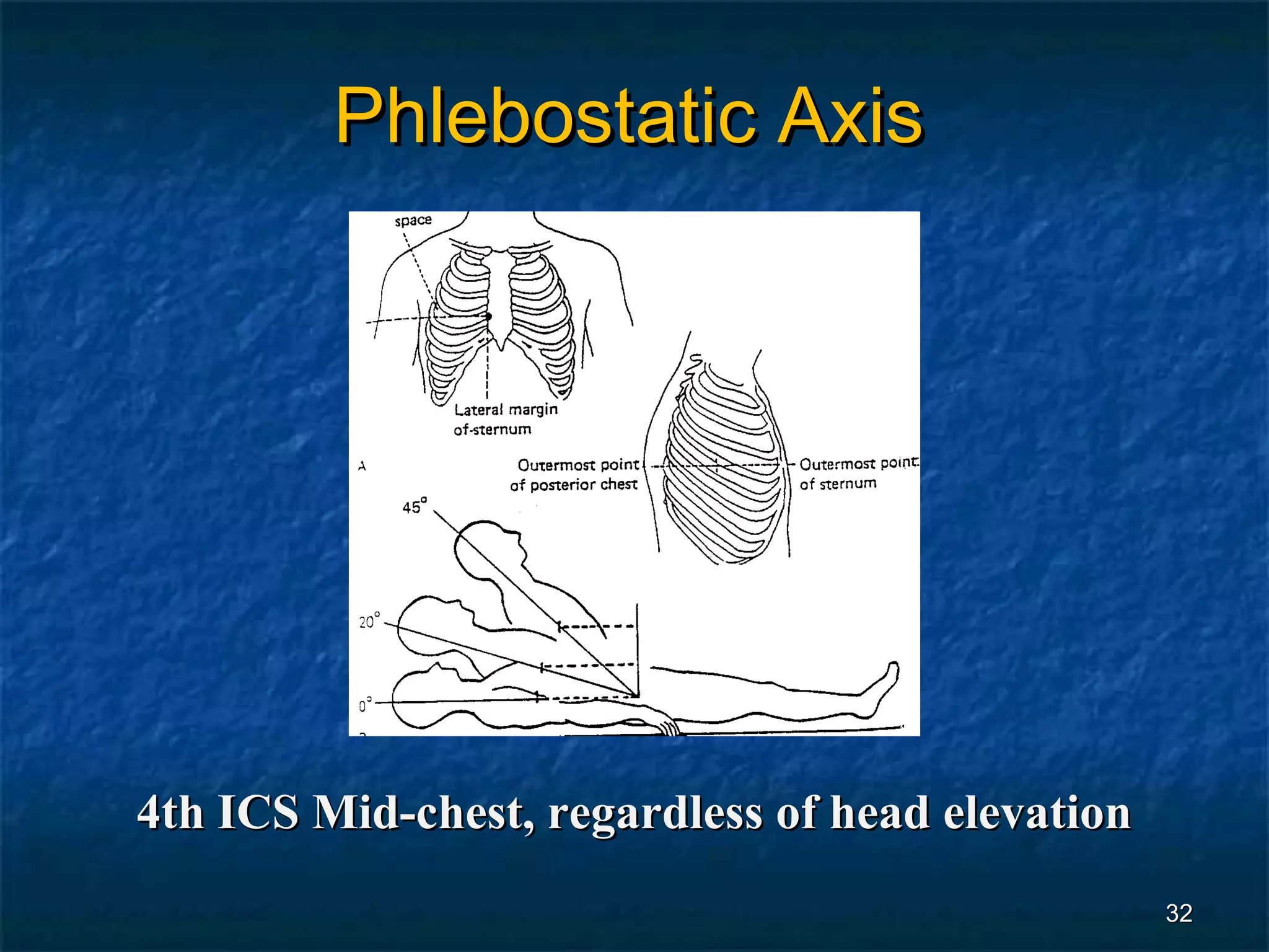 Phlebostatic Axis




4th ICS Mid-chest, regardless of head elevation
                                                  32
 