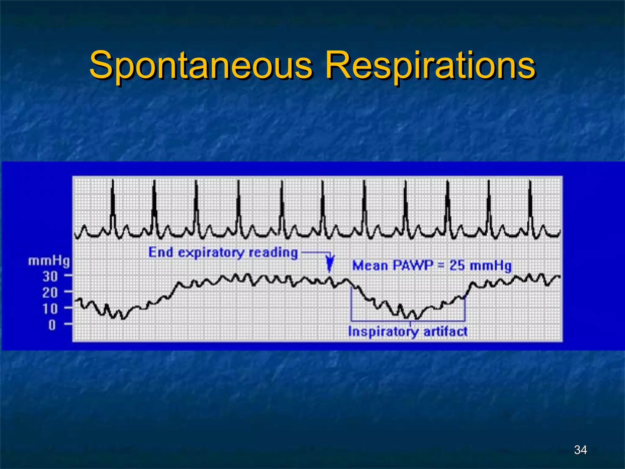 Spontaneous Respirations




                           34
 