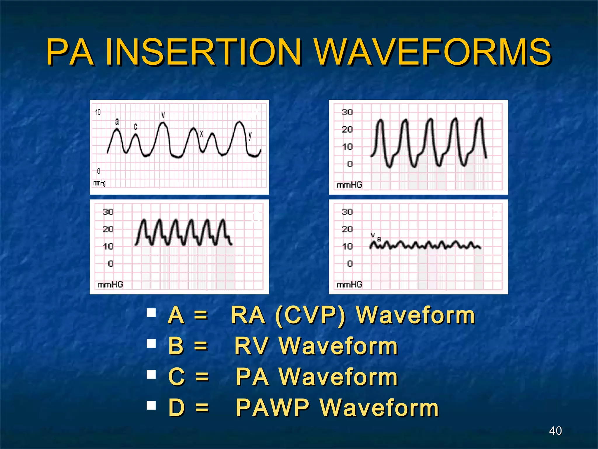 PA INSERTION WAVEFORMS
               A                  B




               C                  D




       A   = RA (CVP) Waveform
       B   = RV Waveform
       C   = PA Waveform
       D   = PAWP Waveform
                                      40
 