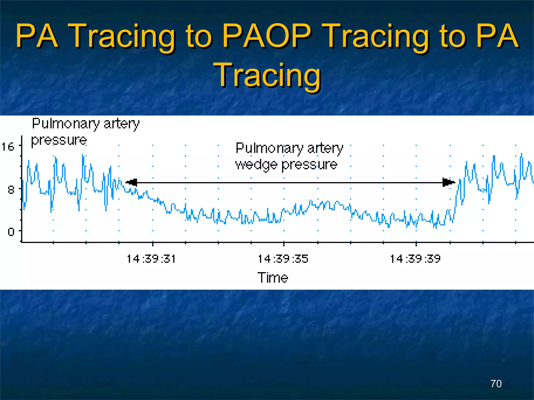 PA Tracing to PAOP Tracing to PA
             Tracing




                              70
 
