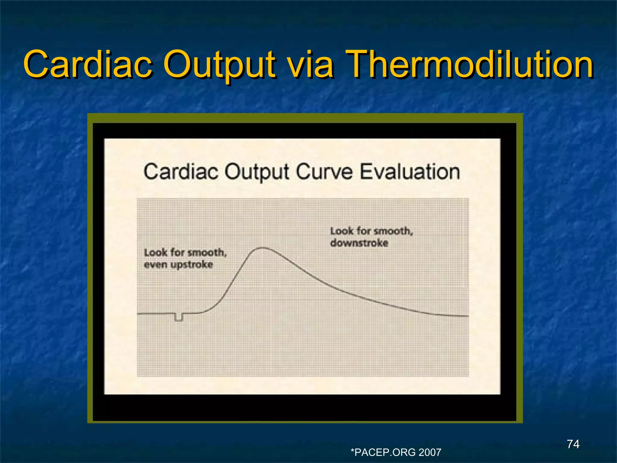 Cardiac Output via Thermodilution




                                    74
                  *PACEP.ORG 2007
 