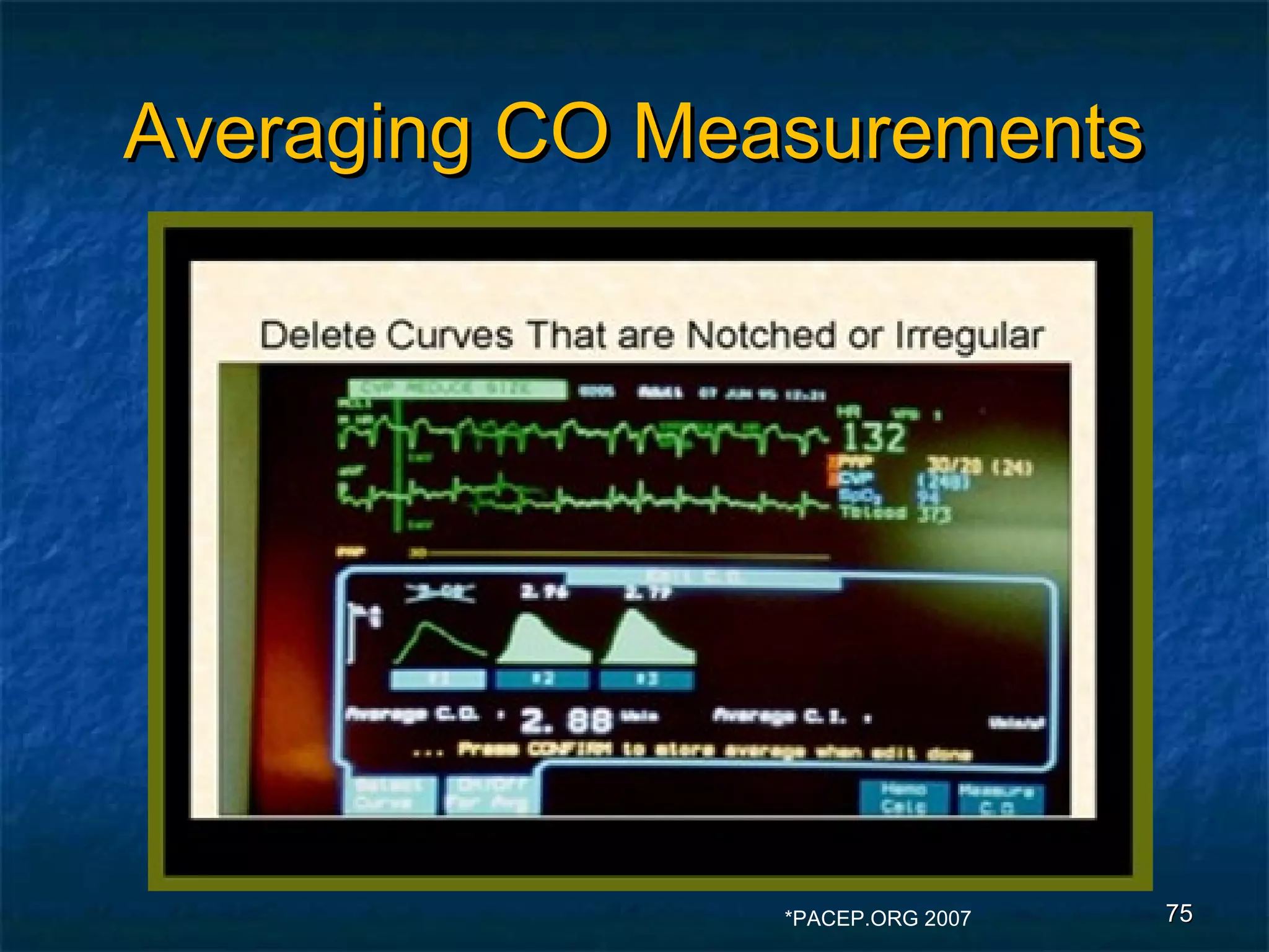 Averaging CO Measurements




                *PACEP.ORG 2007   75
 