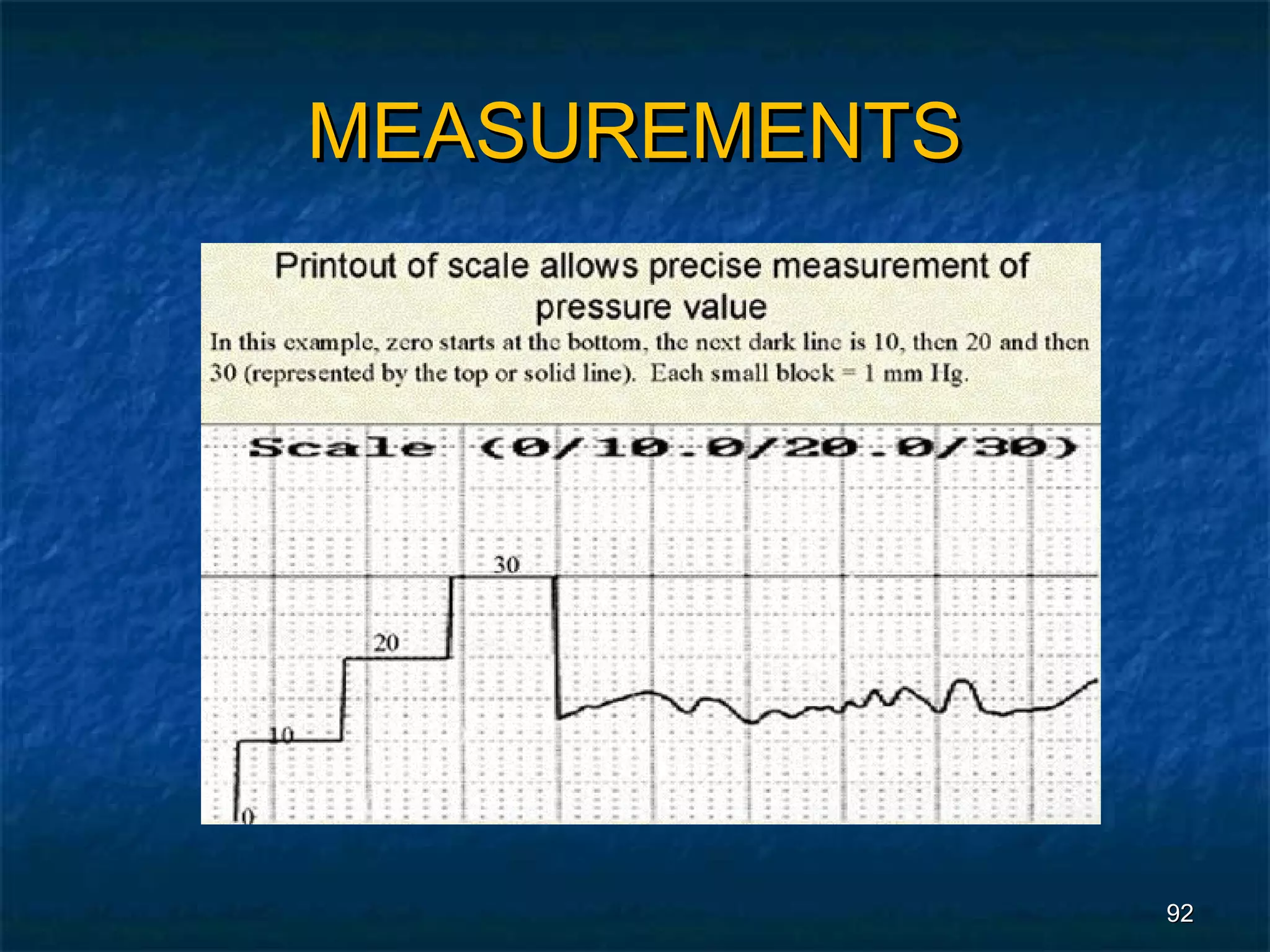 MEASUREMENTS




               92
 