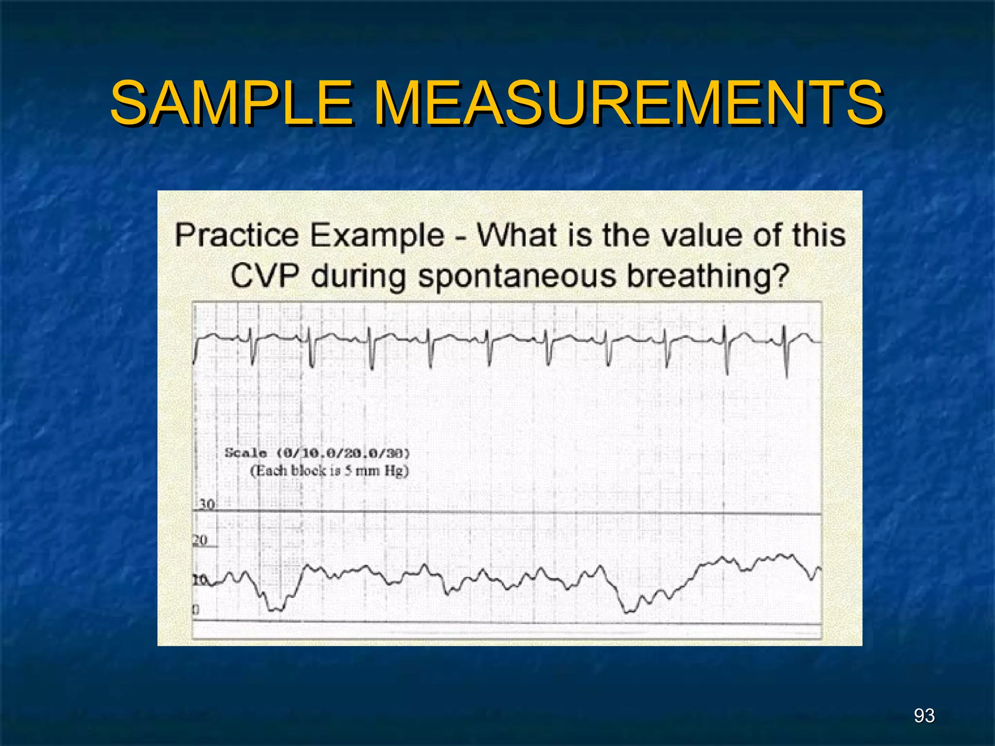 SAMPLE MEASUREMENTS




                      93
 