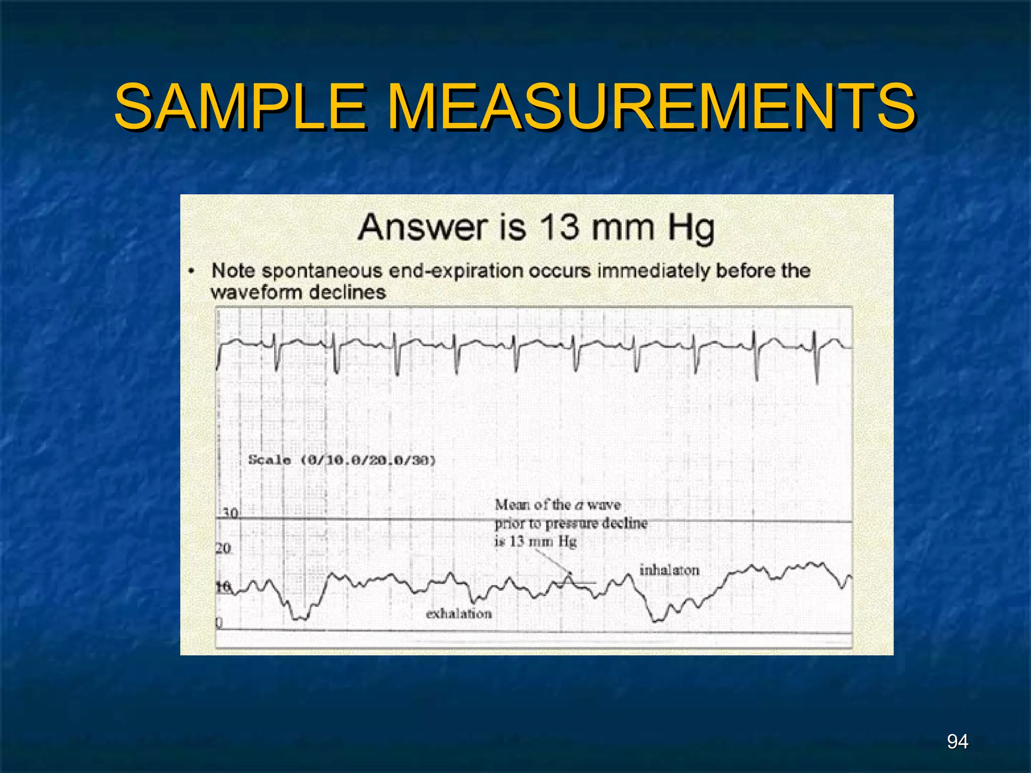 SAMPLE MEASUREMENTS




                      94
 