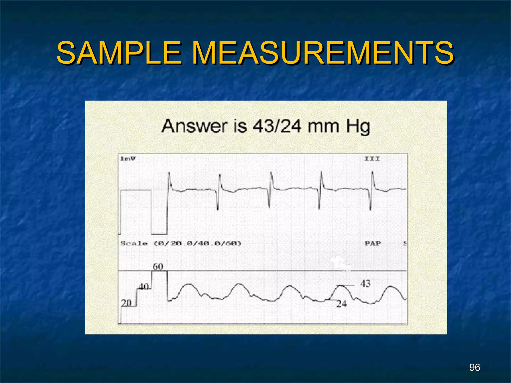 SAMPLE MEASUREMENTS




                      96
 