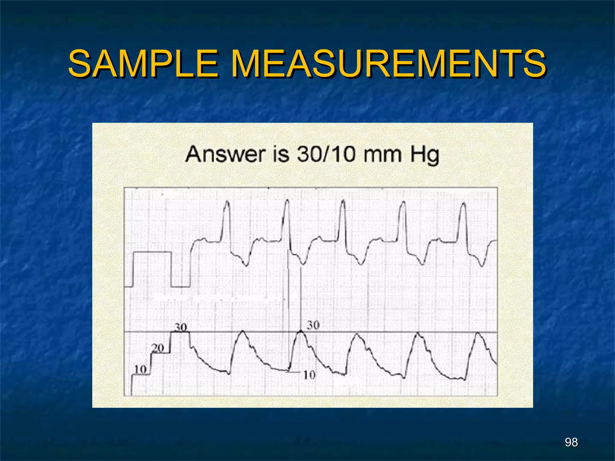 SAMPLE MEASUREMENTS




                      98
 