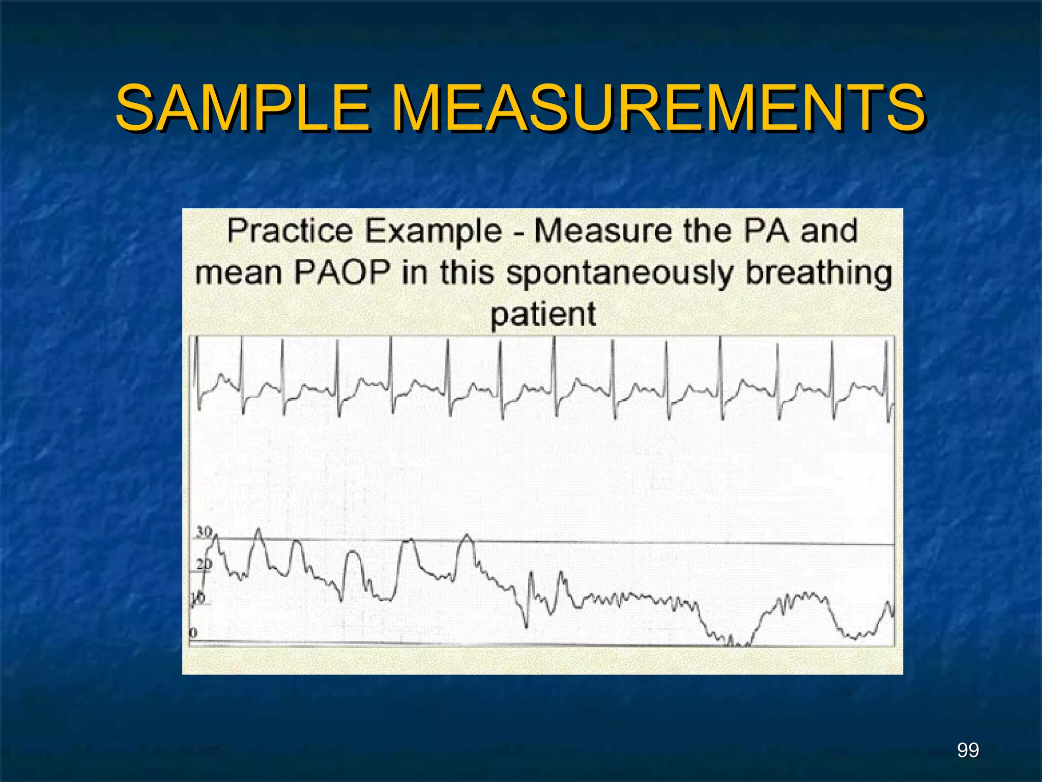 SAMPLE MEASUREMENTS




                      99
 