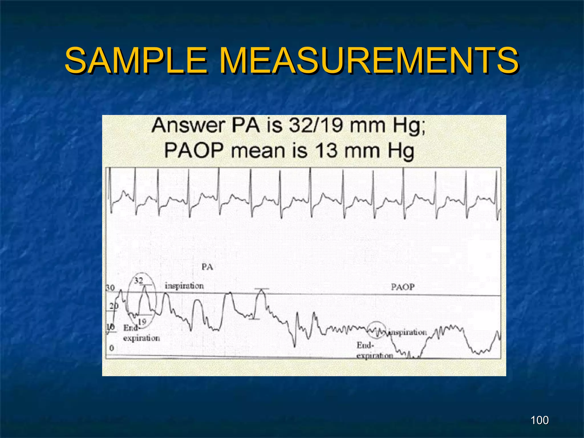SAMPLE MEASUREMENTS




                      100
 