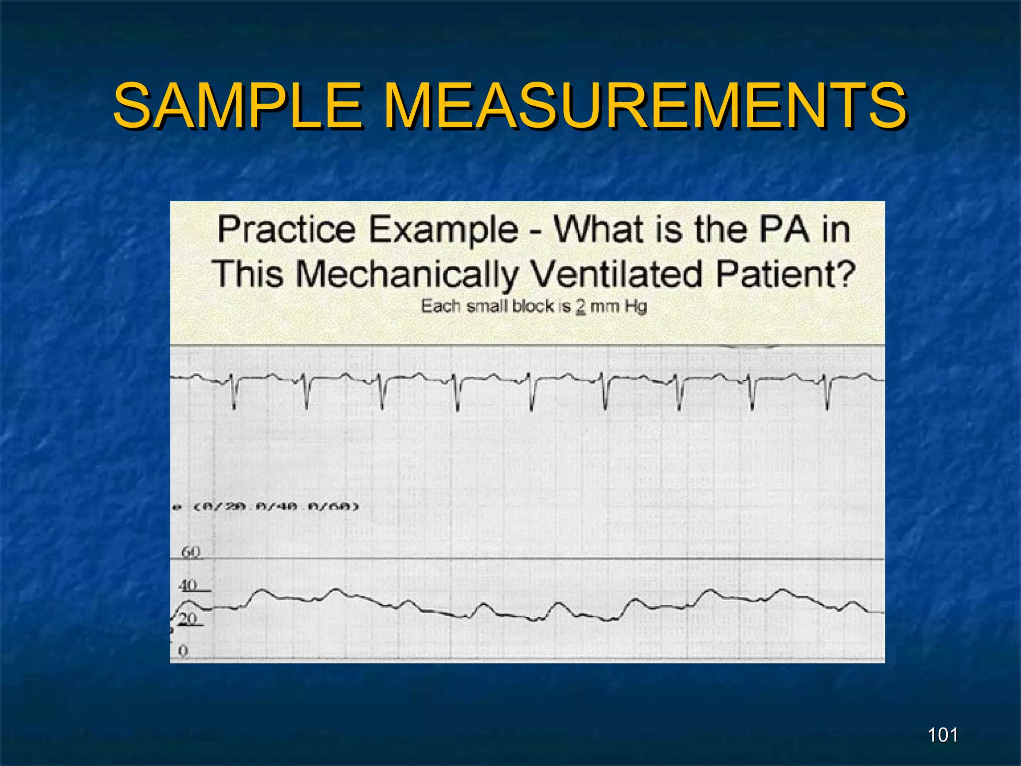 SAMPLE MEASUREMENTS




                      101
 
