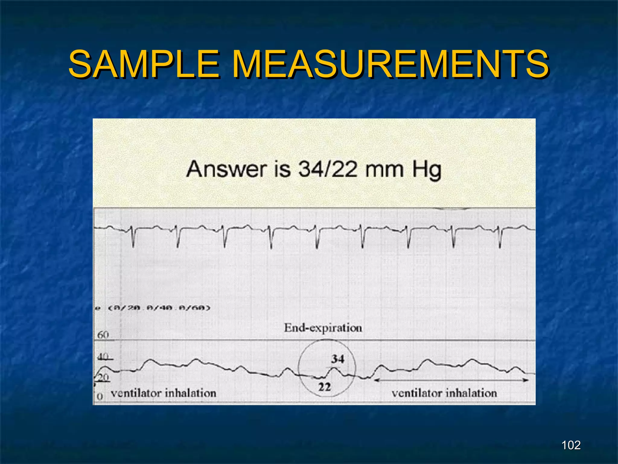 SAMPLE MEASUREMENTS




                      102
 